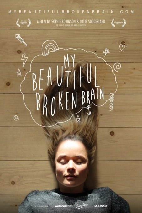 L'affiche du film My Beautiful Broken Brain